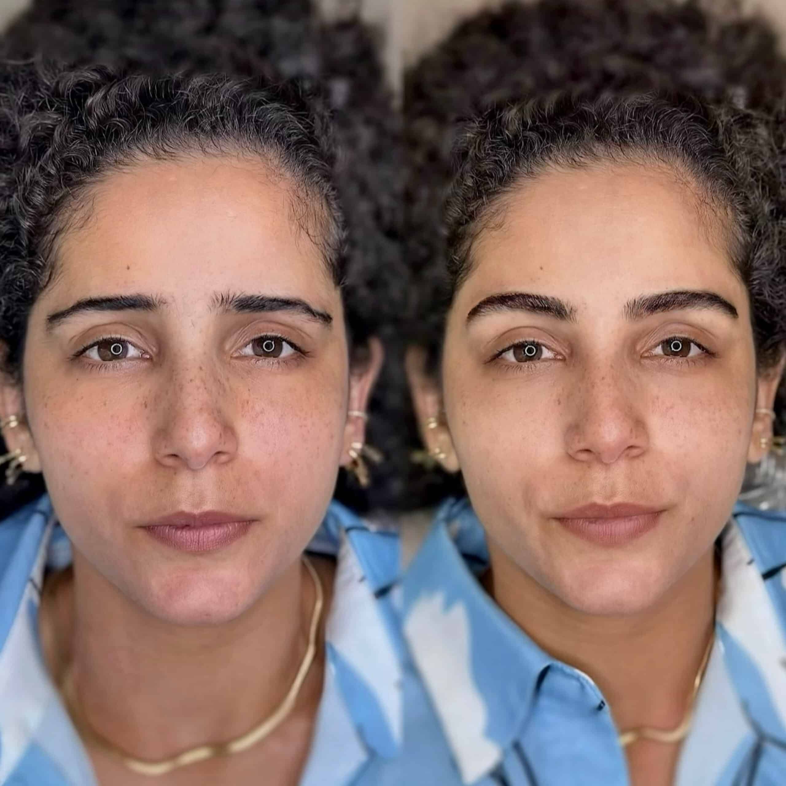 שיטת השערה היפראליזם